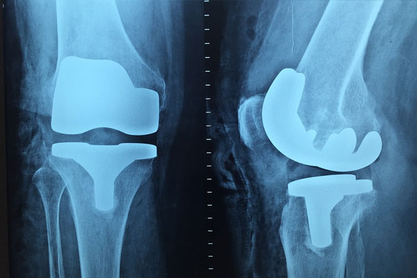 orthopedic-issues